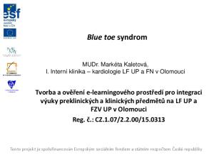 Blue toe syndrom. MUDr. Markéta Kaletová, I. Interní klinika kardiologie LF UP a FN v Olomouci